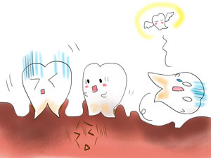 歯周病とは何か?