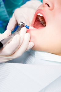 虫歯予防のための診療では具体的に何をするのか