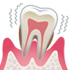 歯周病治療
